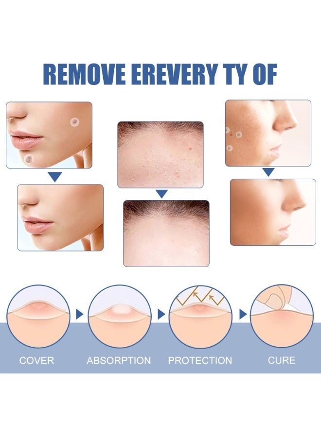 إيلهو EELHOE الثآليل التصحيح 144 قطعة الجلد التصحيح يمكن إرفاقها على الجلد الشامة السوداء التنظيف الرعاية الذرة إزالة التصحيح - Image 4